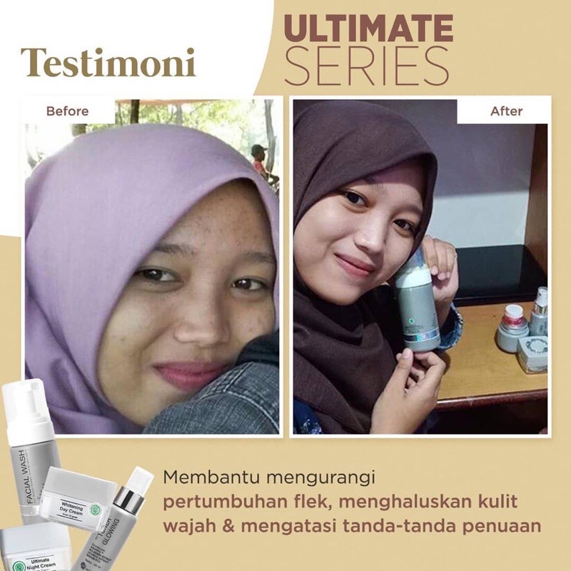 Ultimate Series by MS Glow