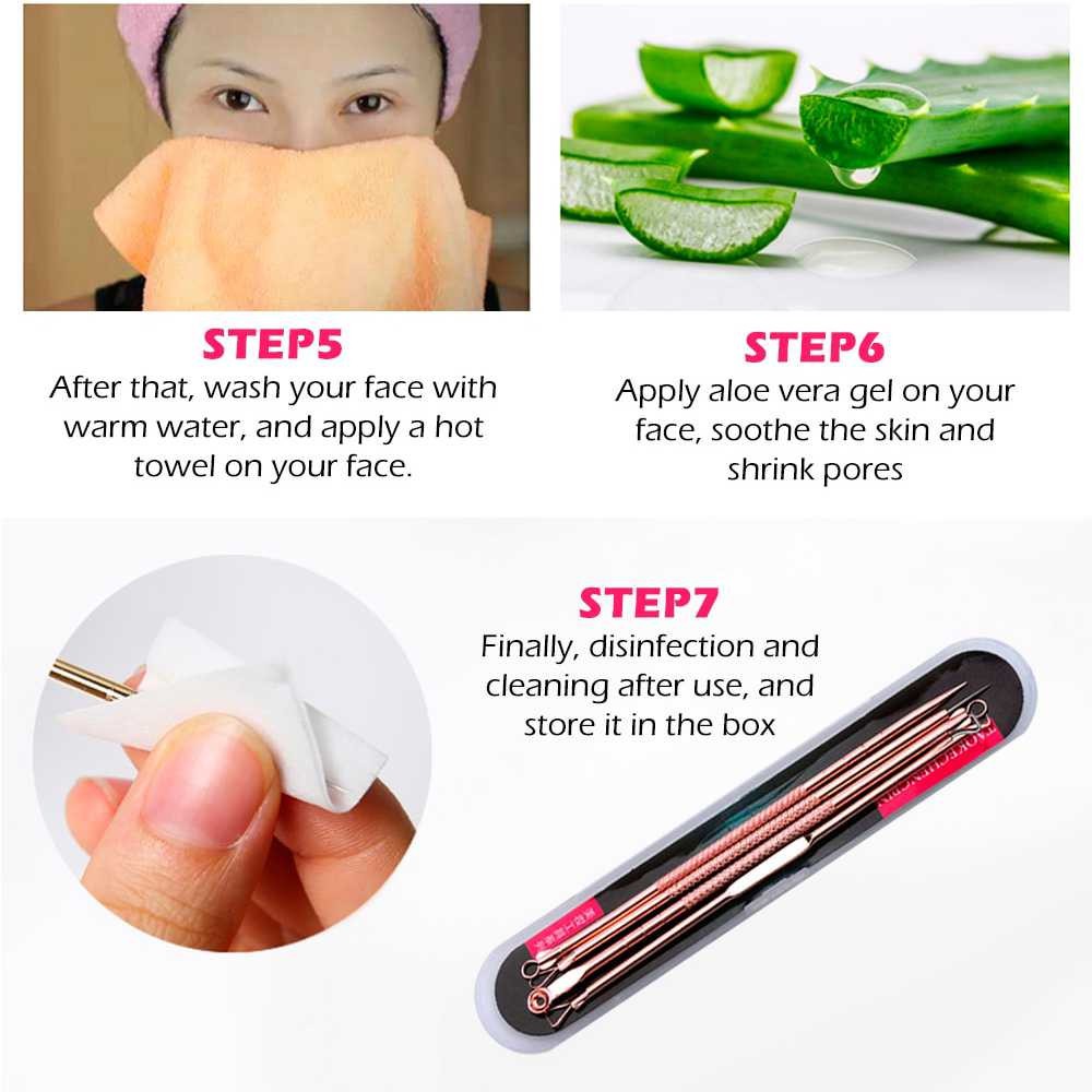 Perlengkapan Perawatan Wajah Stainless Steel Peralatan Muka Anti Jerawat&amp;Komedo 4PCS Aman Digunakan