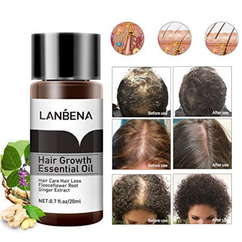 Lanbena Hair Growth Essential Oil / Serum Penumbuh Rambut / Serum Penyubur Rambut Botak / Obat Penumbuh Rambut Rontok / Minyak Rambut Rontok / Minyak Melebatkan Rambut / Minyak Penumbuh Rambut / Minyak Penyubur Rambut / Obat Rambut Rontok &amp; Botak