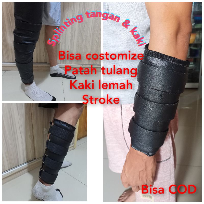 splinting brace tangan kaki badan patah tulang alat penopang tubuh