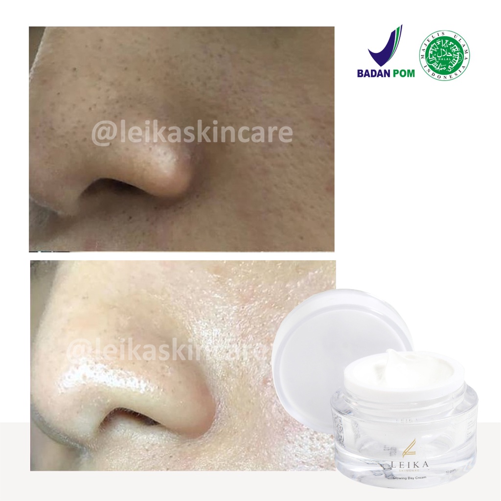 Krim Penghilang Komedo dan Jerawat di Hidung Cocok untuk Pria Wanita Krim penghilang komedo hitam membandel di hidung di wajah Glowing Day Cream Leika Skincare 10gr Korea Ampuh 100% Halal MUI Resmi BPOM