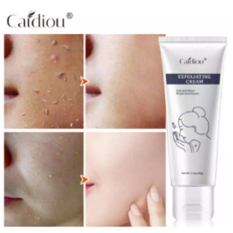 PENGHILANG KULIT MATI REMOVE DEAD SKIN CARE EXFOLIATING CAIDIOU