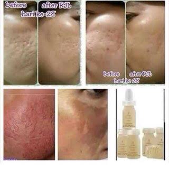 Serum Royal Jelly Jafra Shopee Indonesia