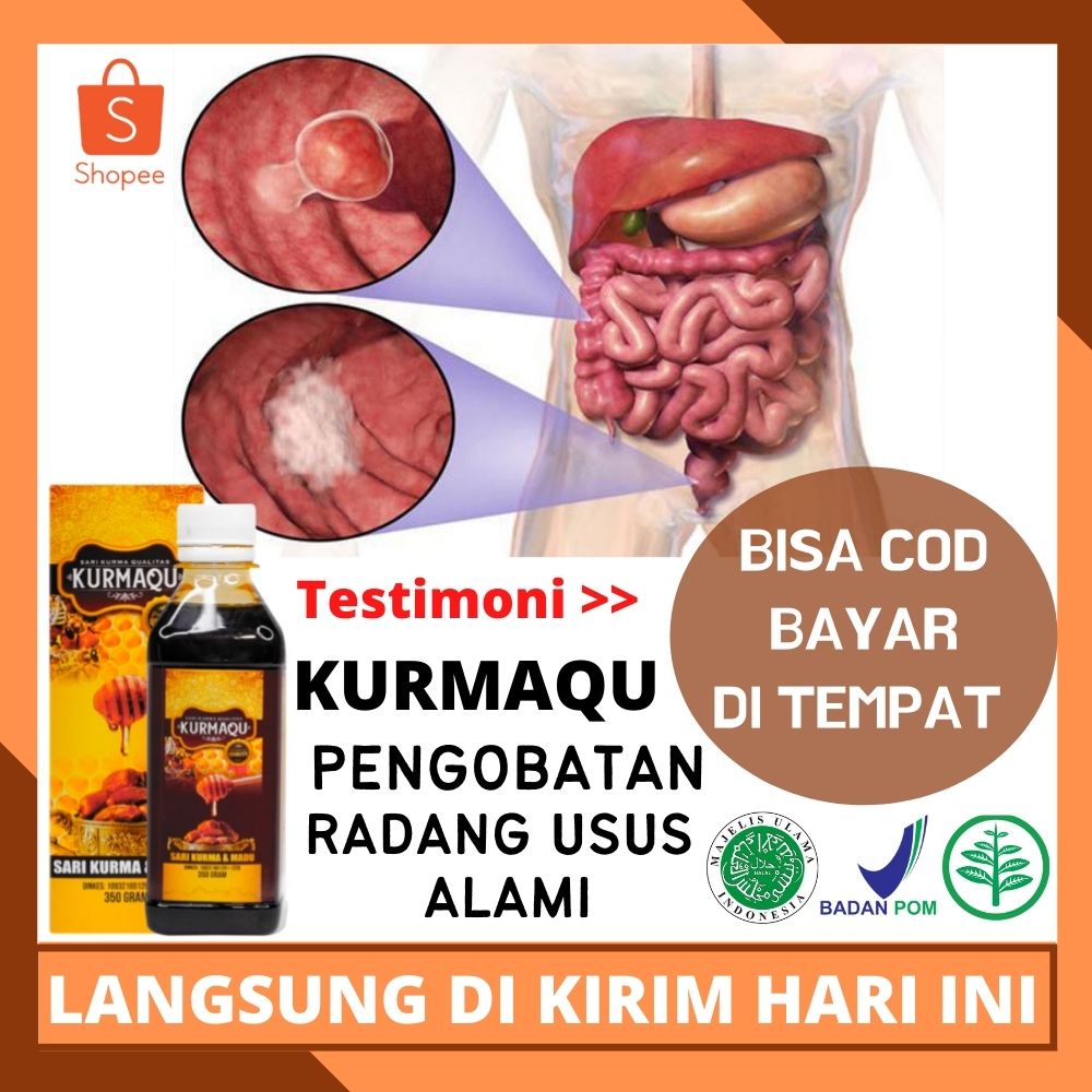 Solusi Pengobatan Radang Usus Alami , Obat Usus Luka, Usus Kotor,  Obat Gangguan Pencernaan, Obat Lu
