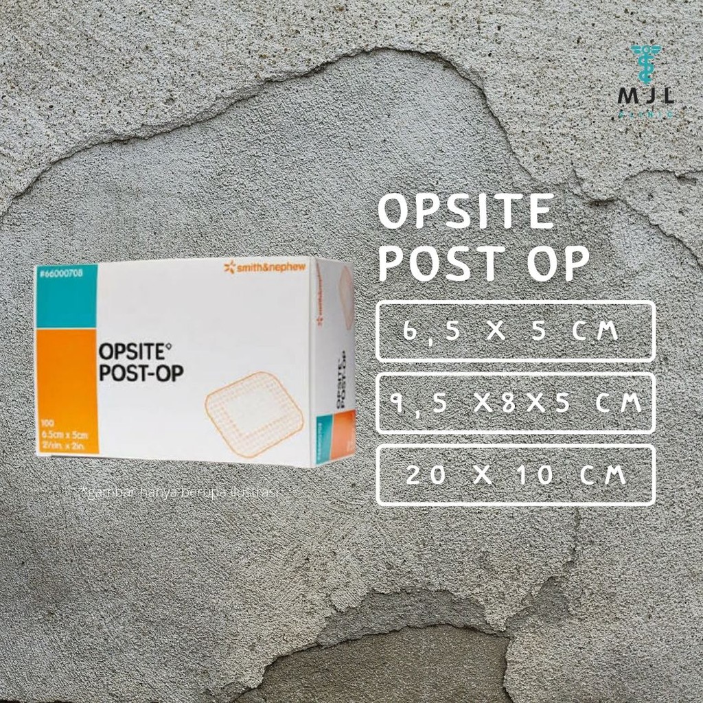 

Opiste Post-OP