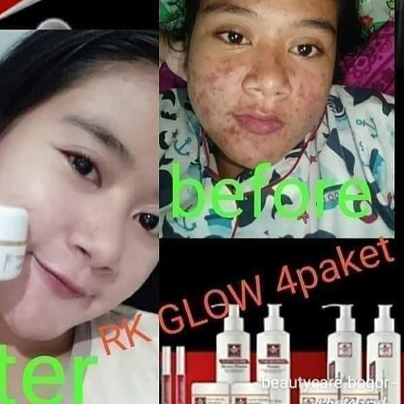 ☟ PAKET RK GLOW PREMIUM / CREAM RK GLOW ACNE / CREAM RK GLOW PREMIUM ORIGINAL 100% - RK CUSHION PREM