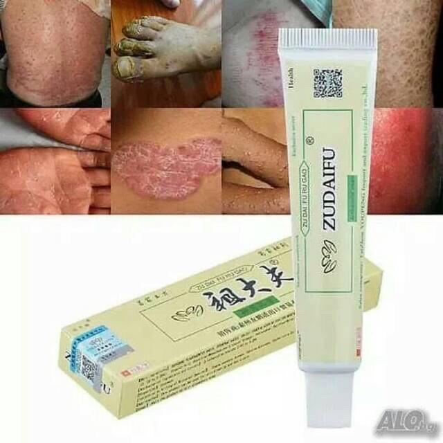 Skin / Obat Cina Salep Krim Untuk Gatal Gatal Eksim Dan Masalah Kulit