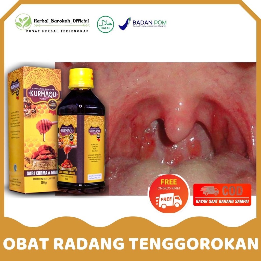 Jual Obat Radang Tenggorokan Herbal Nyeri Tenggorokan Kering