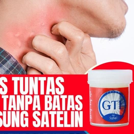 ♘ Kulit Gatal Alergi Satel GTL ☈