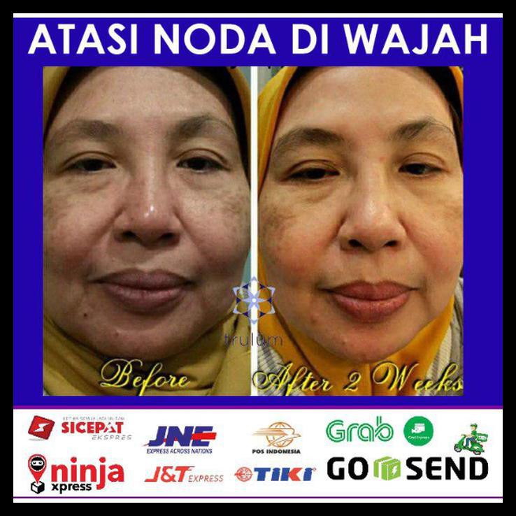 Terbaru Termurah Terlaris Trulum Original 15 Ml Synergy