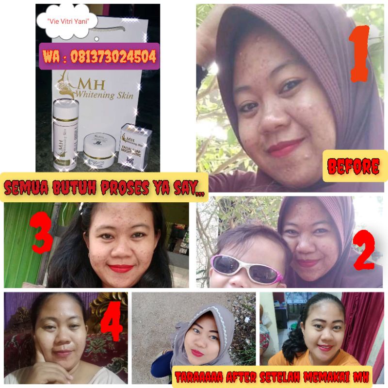MH Whitening skin