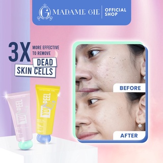 LIZBEAUTY - Madame Gie Madame You Peel Me - Peeling Gel - Masker