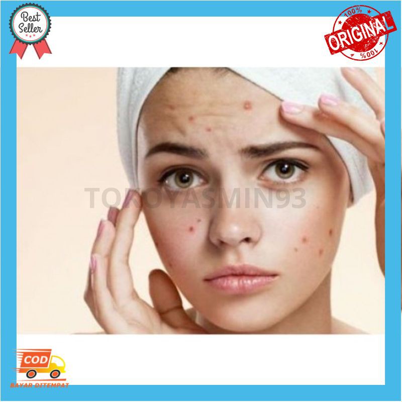 La Tulipe Acne Care Gel Murah