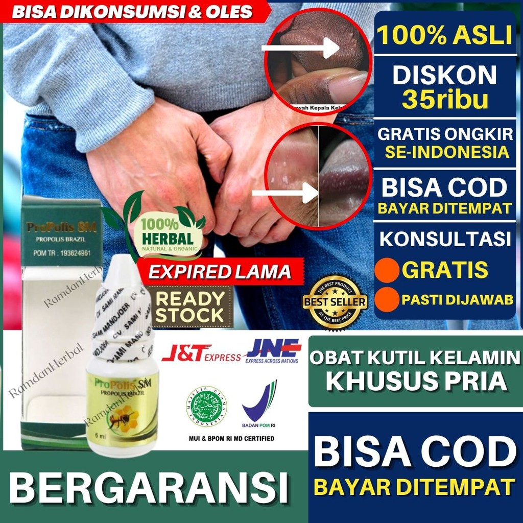 Obat Kutil Kelamin Khusus Pria Infeksi Jamur Gatal Gatal Benjolan HPV Gatal Herpes Genital Simpleks Kutil kelamin Jengger ayam Propolis SM