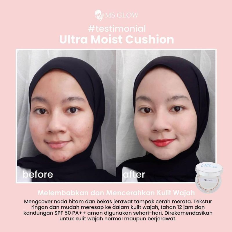 MS glow ultra moist cushion | cushion MS glow | ultra moist cushion ms glow | bedak padat MS glow