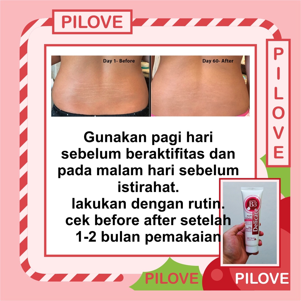 PILOVE - BISA COD Obat Salep Gel Lotion Cream Krim Penghilang Sterchmark / Strechmark Strech Mark Paling Ampuh Cream Penghilang Strecmark Sterch Mark Stretch Mark Cream Selulit Ibu Hamil dan Setelah Melahirkan Yang Paling Ampuh BPOM Permanen