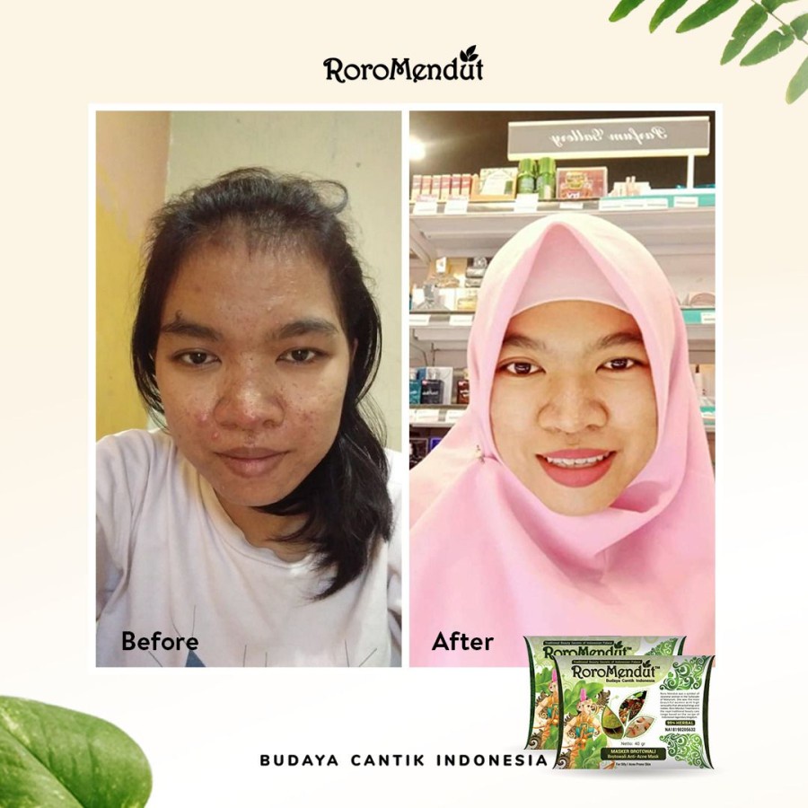 Masker Jerawat Premium Brotowali Roro mendut