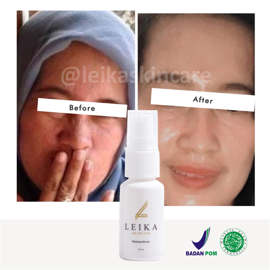 Menakjubkan! Serum Wajah Anti Penuaan Dini Serum Anti Aging Whitening Terbaik BPOM Serum Penghilang Kulit Keriput di Kulit Wajah Ampuh Glowing Serum Leika Skincare 12ml Halal MUI Resmi BPOM