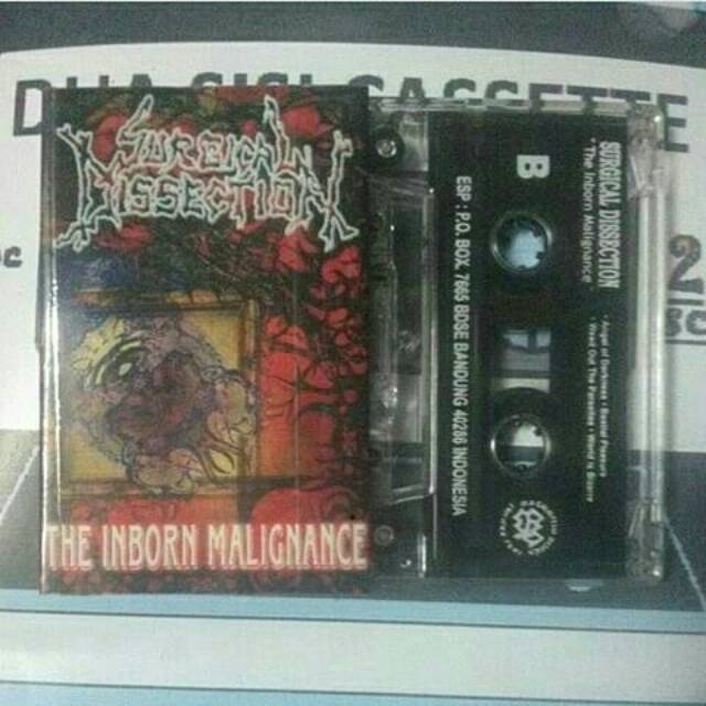 Kaset pita surgical dissection - the inborn malignance
