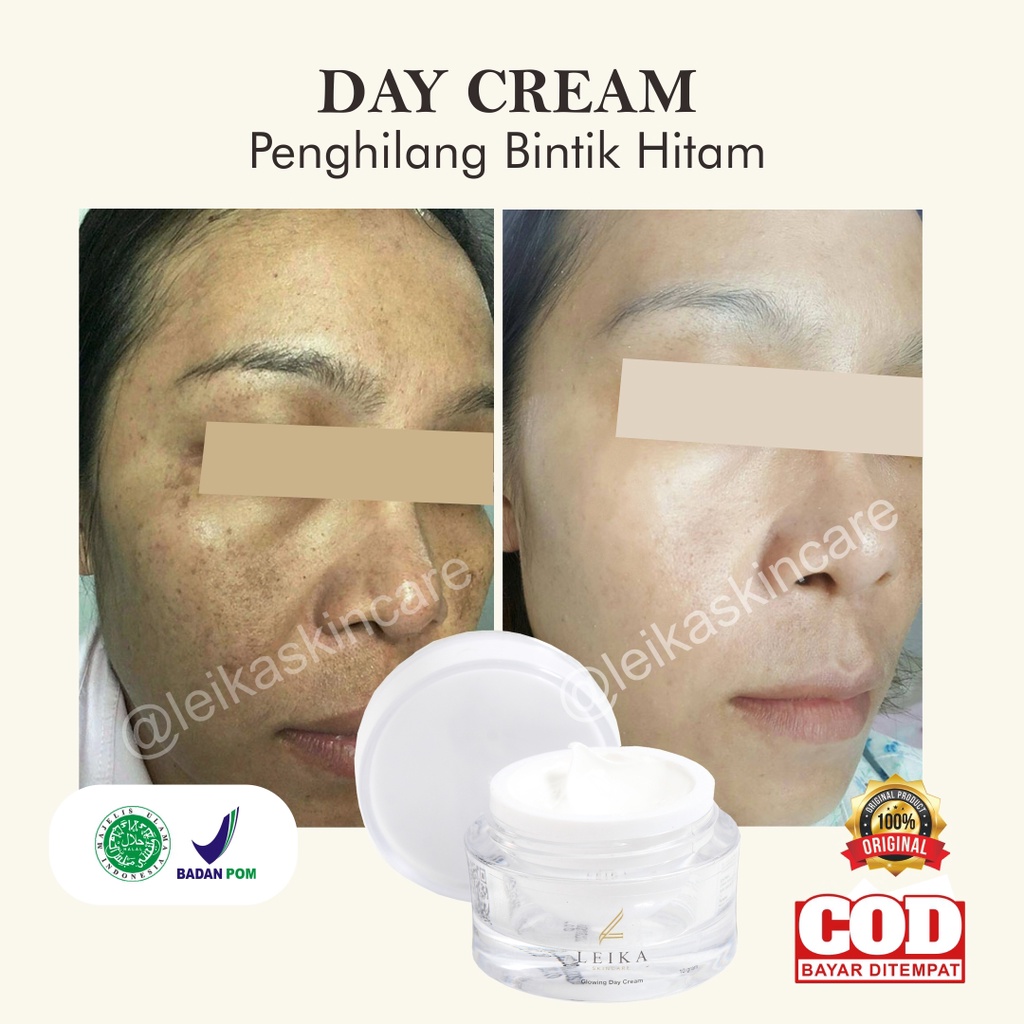 Perawatan Krim Penghilang Bintik Dan Flek Hitam Di Wajah Day Cream Bintik Hitam Cream Penghilang Bin
