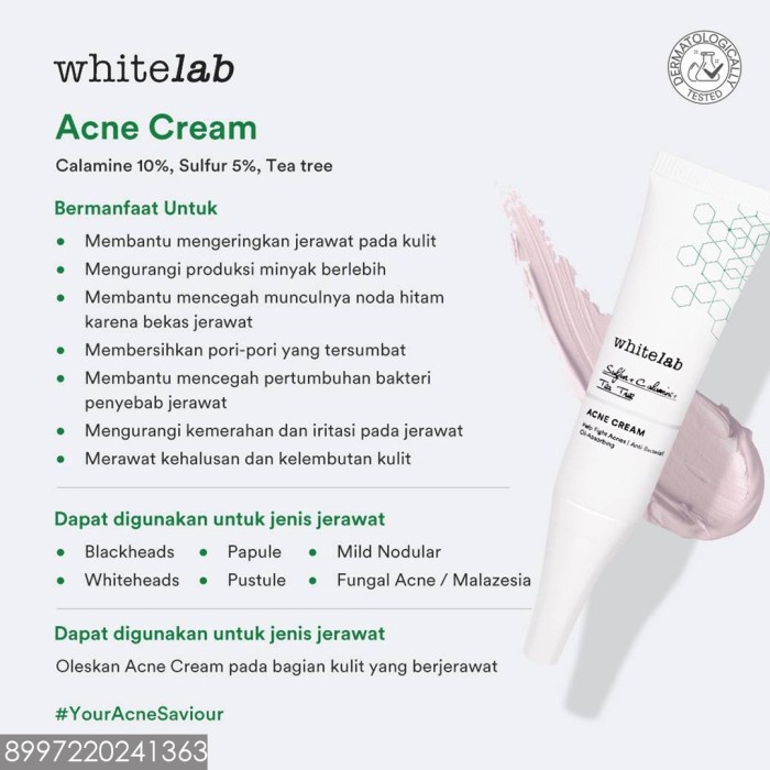 Whitelab WL Acne Cream tidak ada jerawat lagi