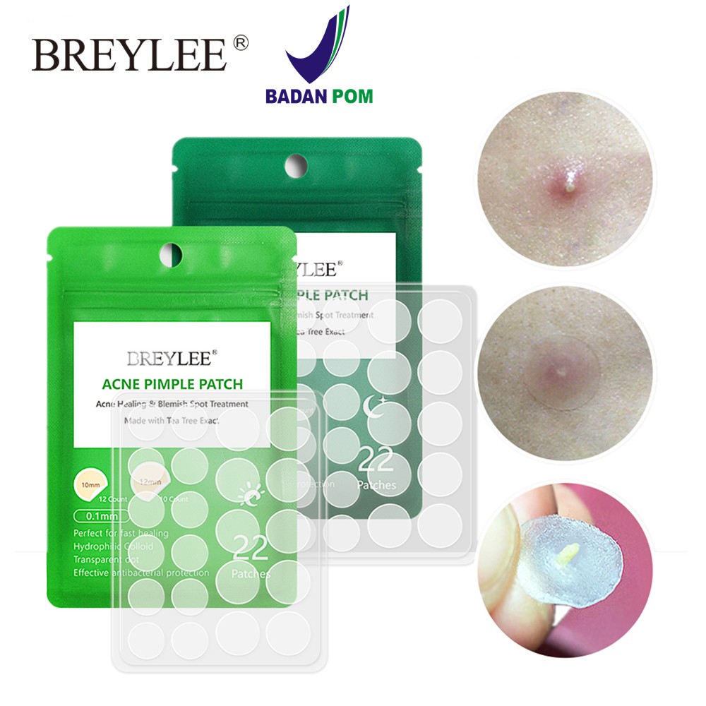 BREYLEE ANCE PIMPLE PATCH Sticker Jerawat Night 0.3mm | DAY 0.1mm (22 Stiker)