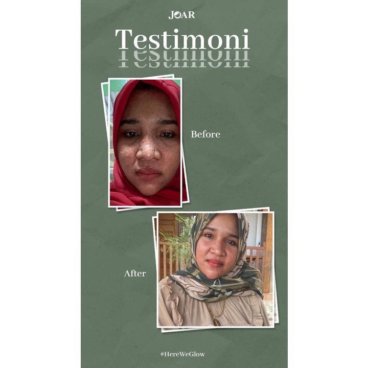 BISA COD !! Joar Brightening Face Serum + Brightening Soap Bar BPOM HALAL - Sabun Muka Pria Jerawat - Sabun Wajah Pemutih Glowing - Obat Jerawat Ampuh