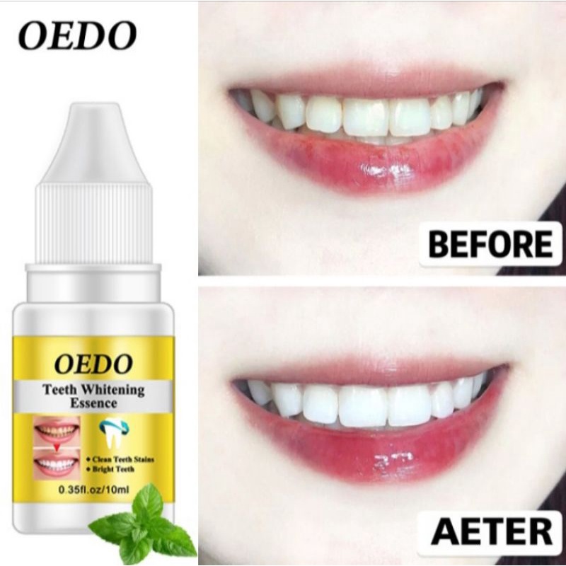 OEDO TEETH WHITENING ESSENCE | PEMUTIH GIGI PERMANEN