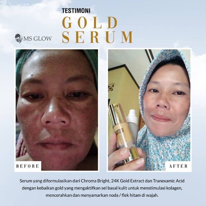 SerumJerawat&FlekMsGlow