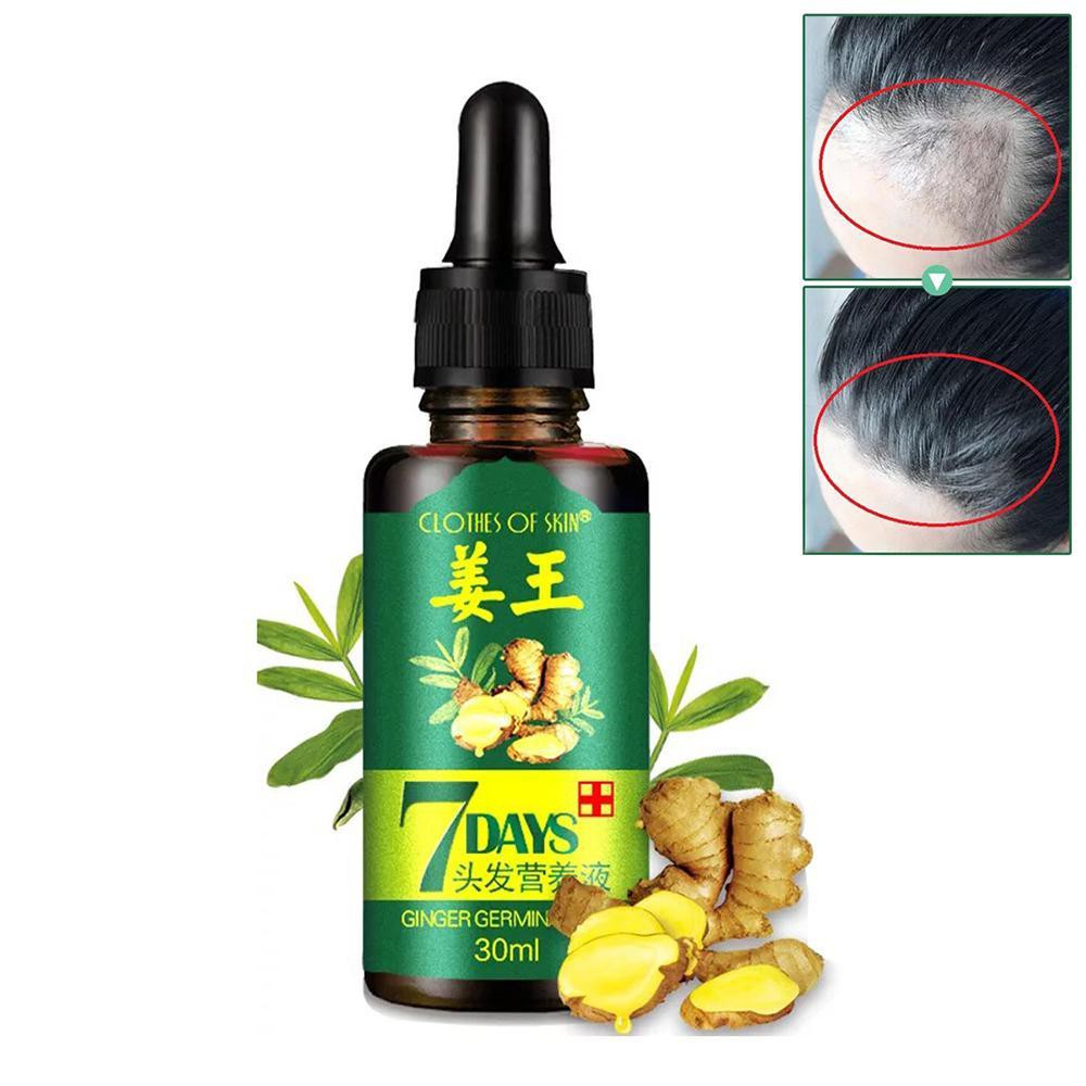 SERUM RAMBUT ANTI BOTAK Clothes of Skin Ginger Germinal Oil 30 ml