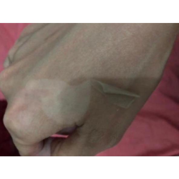 PEELING PENGELUPASAN AMPUH NVB0L3556