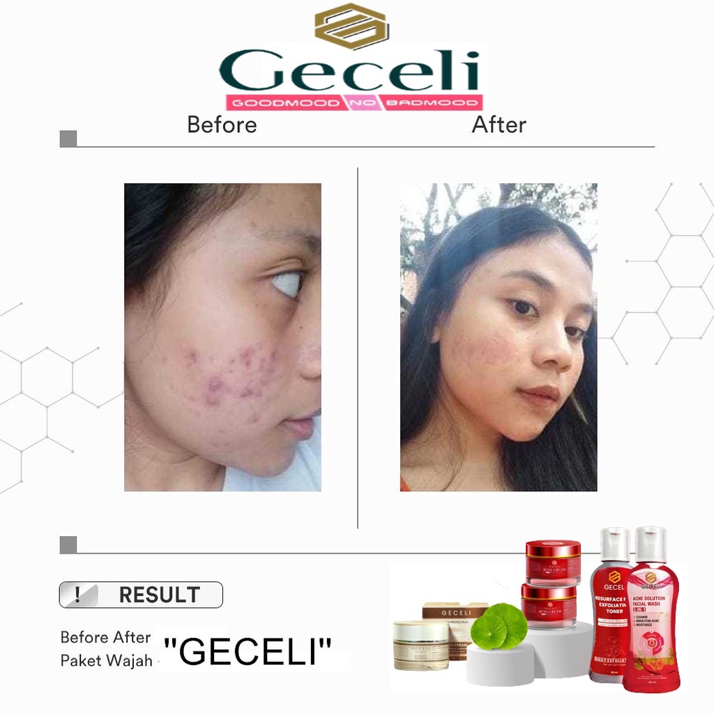 PAKET SABUN GECELI CREAM GECELI ACNE CREAM SABUN WAJAH GECELI ACNE SOLUTION FACIAL WASH 4 in 1 PAKET