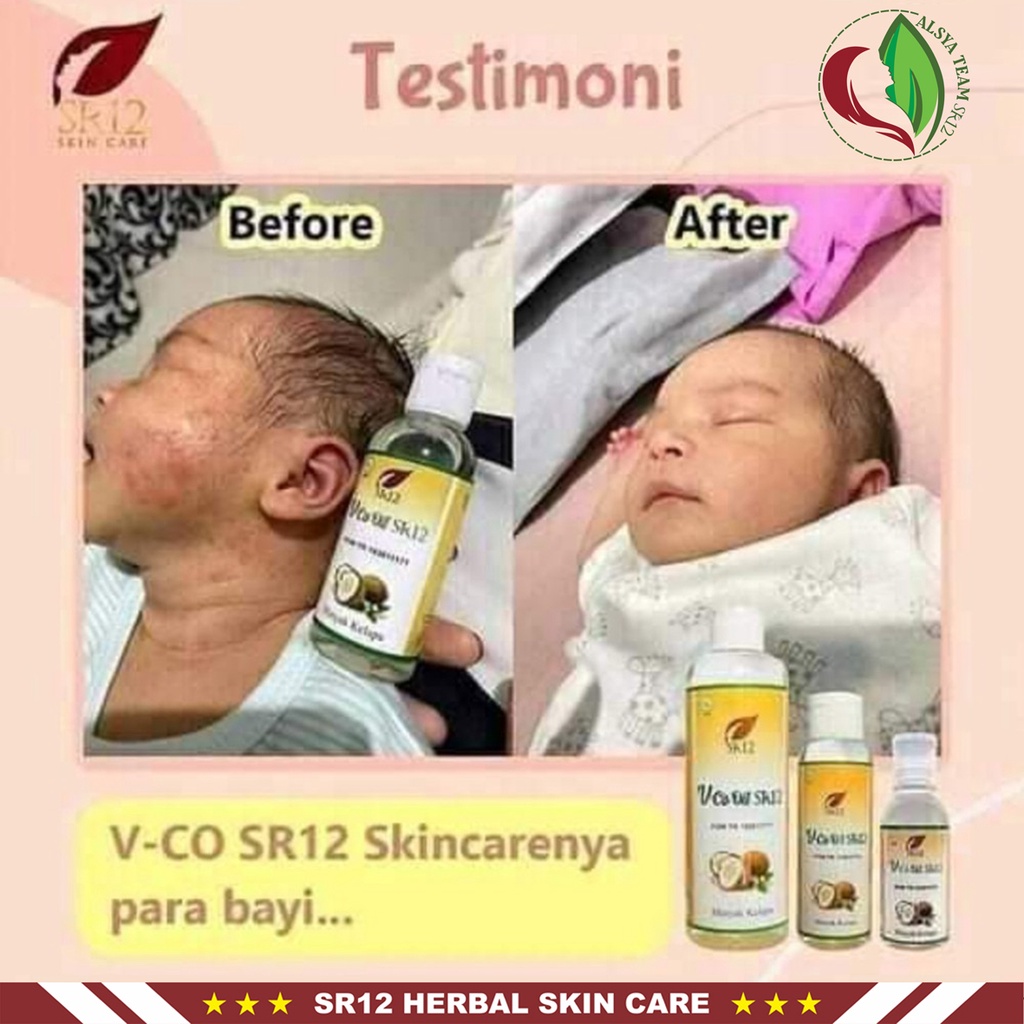 Minyak VCO SR12 | VCO Oil SR12 &amp; VCO Kapsul SR12 | SR12 Herbal Skincare | Memperkuat Imun Tubuh