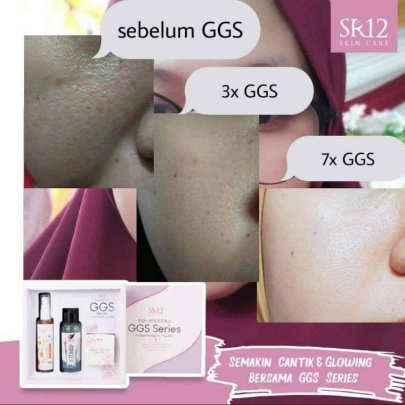 Glow Glass Skin Gel Premium Glasskin Brightening Krim Pemutih Penghilang Bintik Wajah Penghilang Flek Hitam diWajah Brightening Moisture Gel Cream Cream Gel Cream Glowing