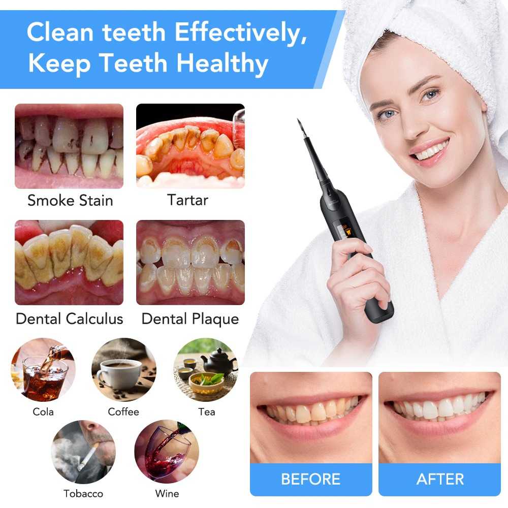 (BISA COD) RVOSTR Hailicare Pembersih Gigi Elektrik Dental Tartar Remover With LCD LR-6