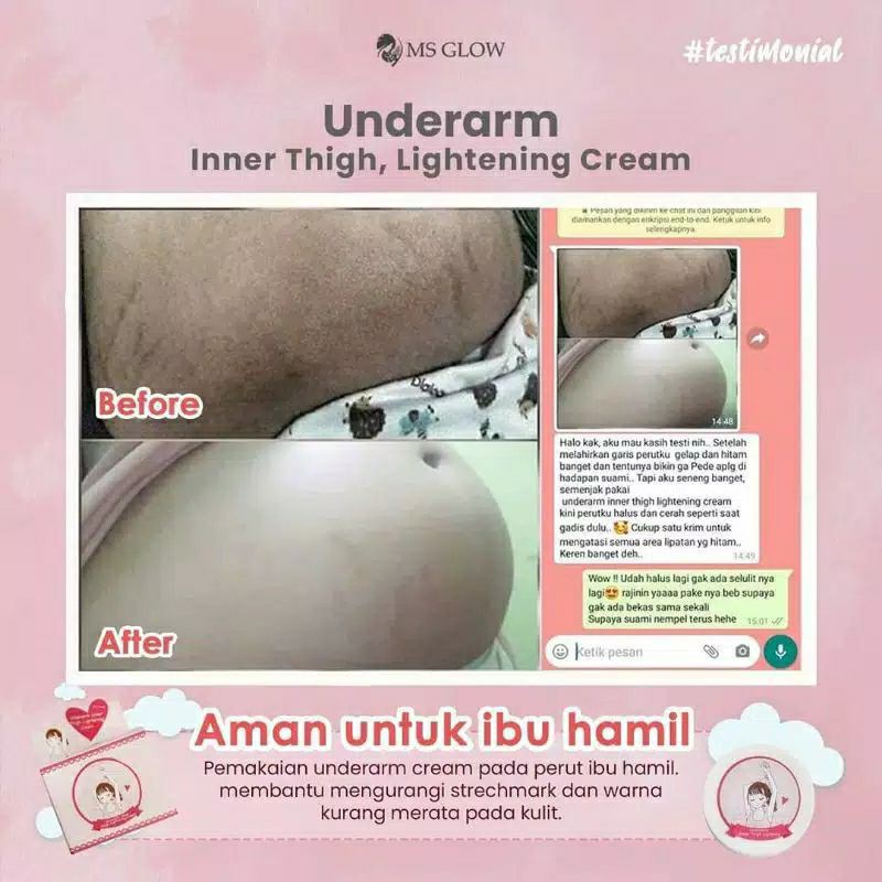 UNDERARM CREAM ORIGINAL by MS GLOW