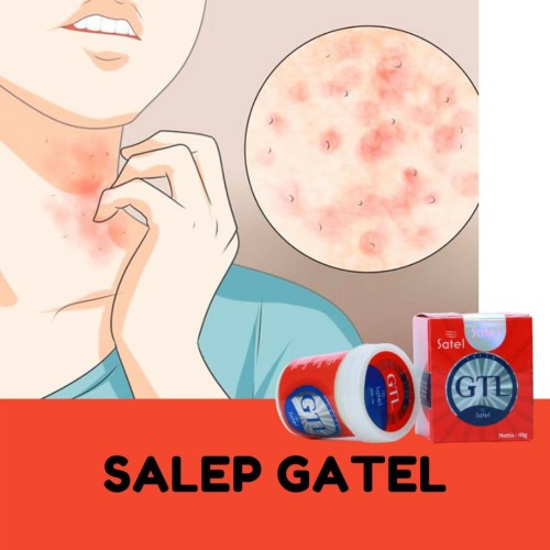 Salep GTL Original 100% Asli Gatel Usir Kudis Kurap Panu Korengan-2