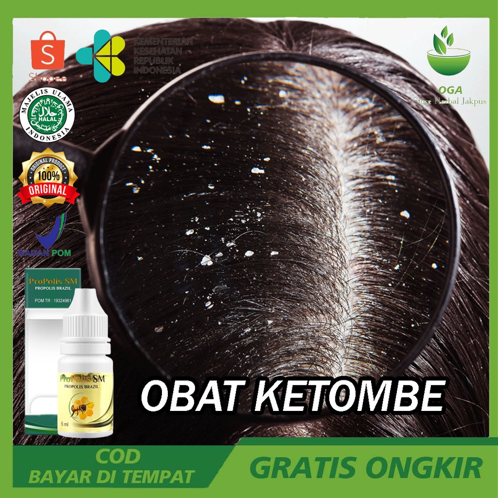 Obat Penghilang Ketombe Di Kepala Jamur Kulit Kepala Psoriasis Borok Di Kepala Pada Anak Dewasa