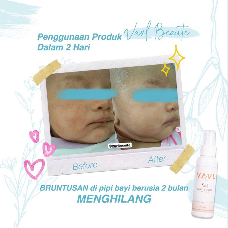 VAVL Beauty Water Blemish [Strong] 100gr Saffron Face Mist BLEMISH Beauty Water/ Face Spray BPOM