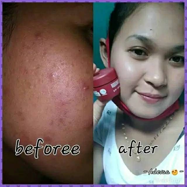 Lc beauty/kf skin