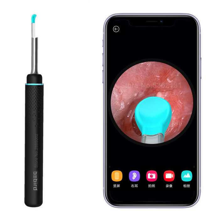 Smart Visual Ear Stick Kamera Endoscope 300W M9 Pro