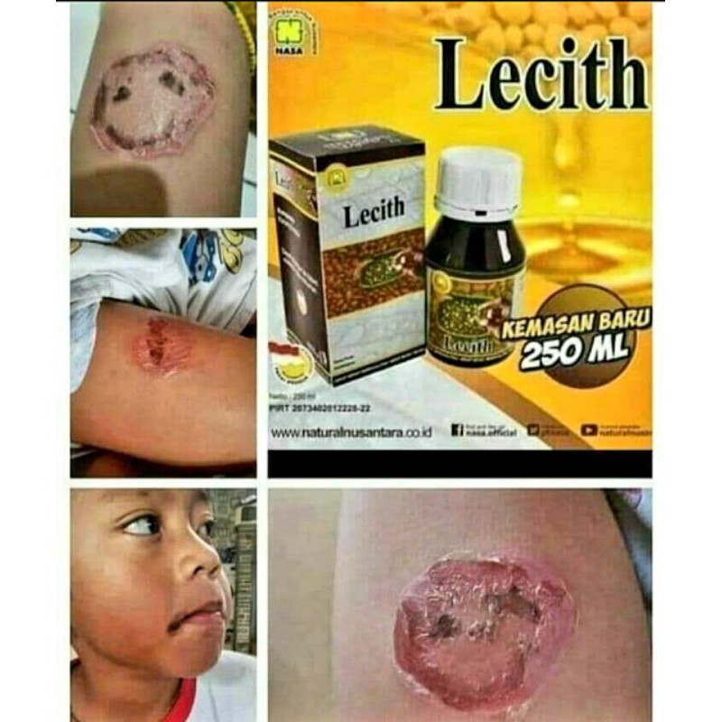 

Lecithin