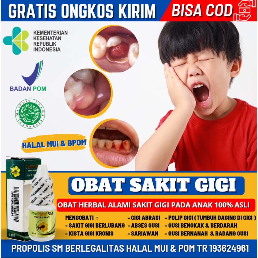 Obat Sakit Gigi Berlubang, Obat Tetes Sakit Gigi Parah, Sariawan, Gusi Bengkak, Herbal Propolis SM