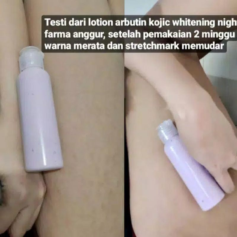 PEMUTIH BADAN HB DOSTING SUPER FARMA PEMUTIH MALAM ANGGUR ARBUTIN KOJIC AMPUH