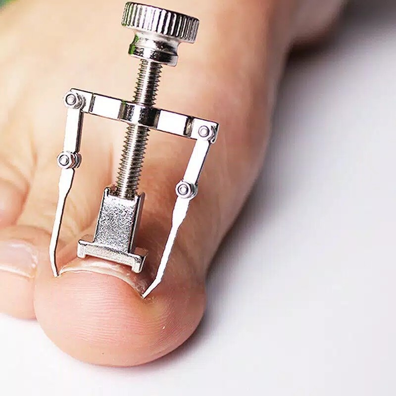 YSO Alat Kuku Cantengan Korektor Terapi Kuku Kaki Memperbaiki Kuku Cantengan - Manicure Pedicure