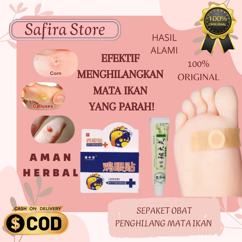 Jual Obat Untuk Kutil Mata Ikan Kapalan Di Kaki Tangan Ampuh Shopee Indonesia