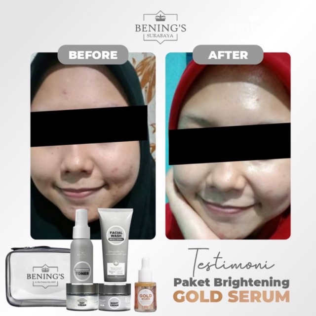 BENING'S PAKET BRIGHTENING | MENCERAHKAN &amp; MENGATASI KULIT KUSAM