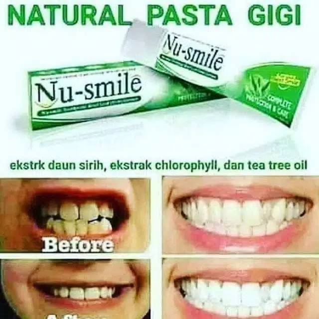 Nu smile pasta gigi
