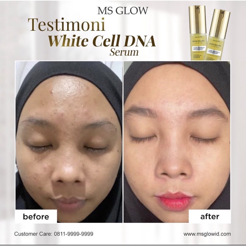 MS GLOW White Cell DNA Night Cream | Serum Msglow White Cell DNA | Toner Essence