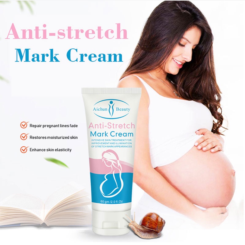 Anti Stretch Mark Cream AICHUN BEAUTY Stretch Mark Removal Bekas Luka Perbaikan Cream Stretch Mark Removal Perawatan Bekas Luka 60g body lotion, pelembab kulit, menghidrasi dan mengangkat